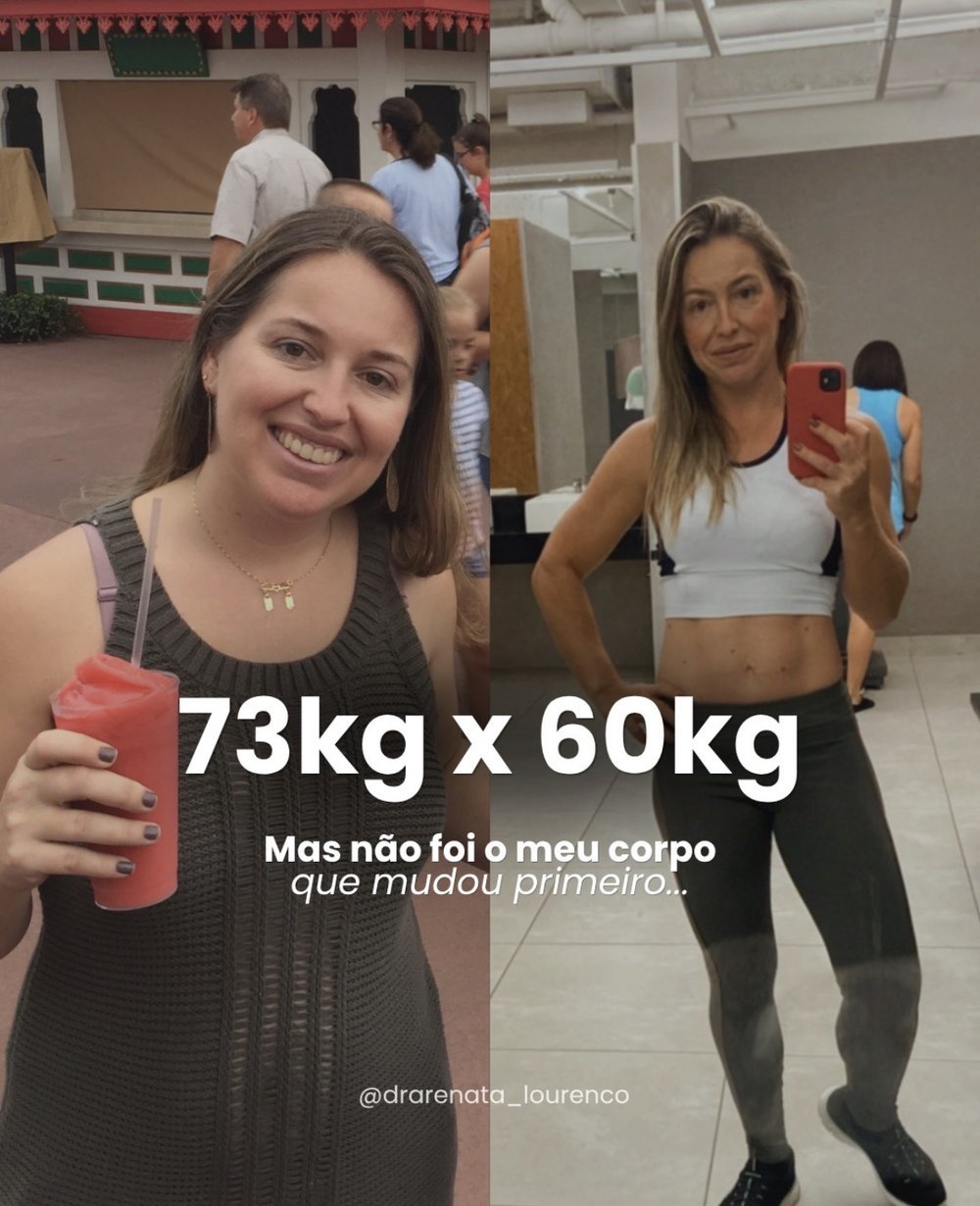 Transformação da Dra. Renata Lourenço: de 73 kg para 60 kg